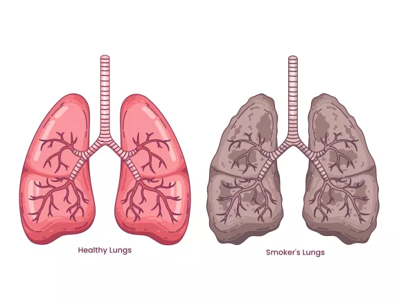 Smoking Lungs